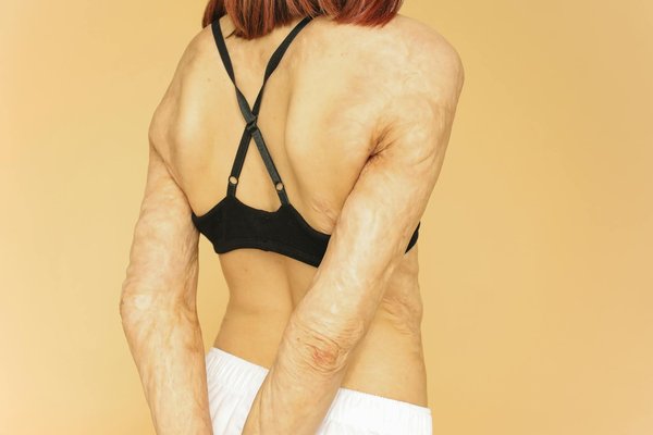 Quels exercices pour soulager le mal de dos au bureau ?