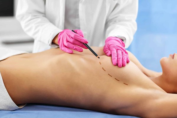 Comment j'ai mis toutes les chances de mon côté pour que mon augmentation mammaire se passe bien